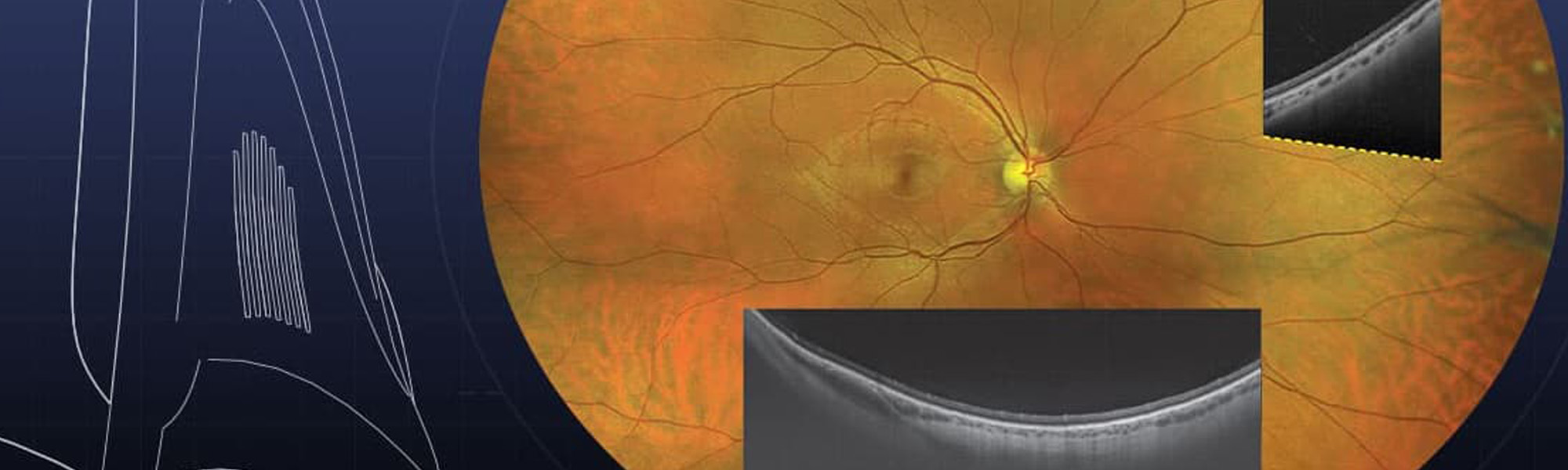 Grant and Glass Opticians - Complete local eyecare you can trust